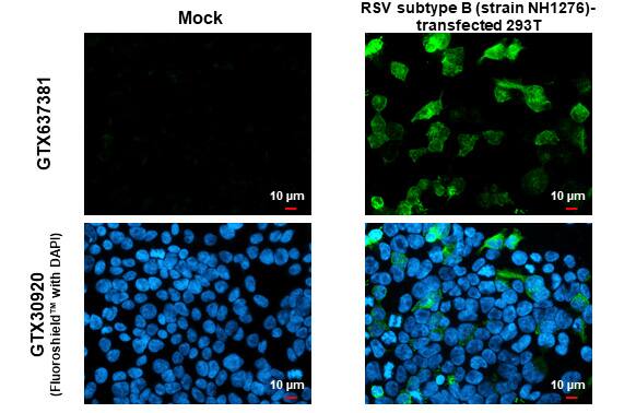 Respiratory Syncytial Virus Glycoprotein G Antibody (HL1733) - Azide and BSA Free