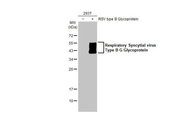 Respiratory Syncytial Virus Glycoprotein G Antibody (HL1733) - Azide and BSA Free