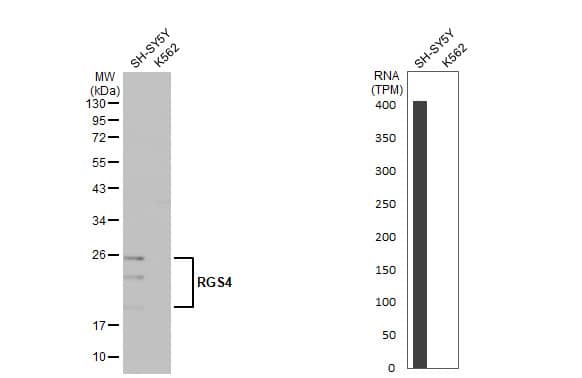 RGS4 Antibody (HL1522) - Azide and BSA Free