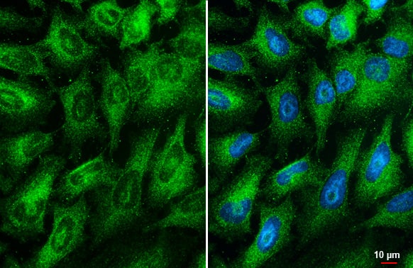 RIPK1/RIP1 Antibody (HL2250) - Azide and BSA Free