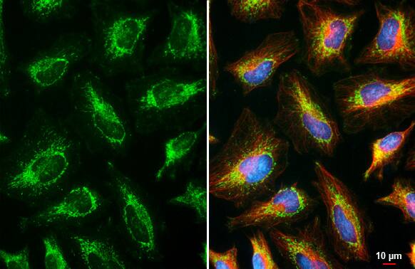 RNase L Antibody (HL2340) - Azide and BSA Free