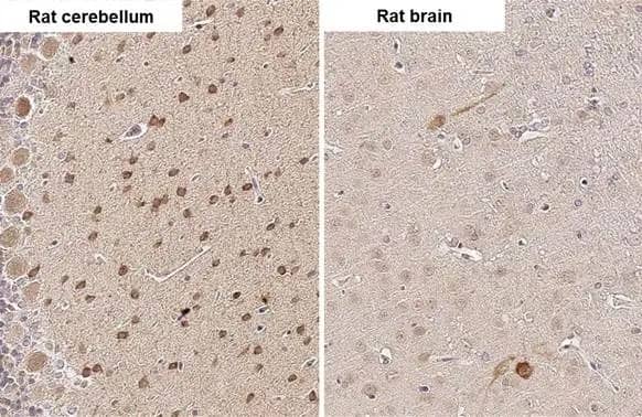 HOIP/RNF31 Antibody (HL2295) - Azide and BSA Free