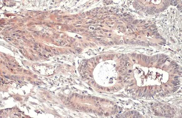 RRM1 Antibody (HL1231) - Azide and BSA Free