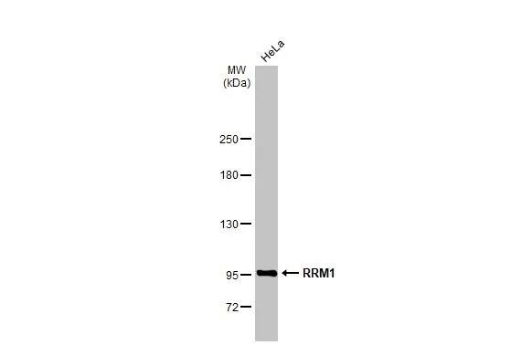 RRM1 Antibody (HL1231) - Azide and BSA Free