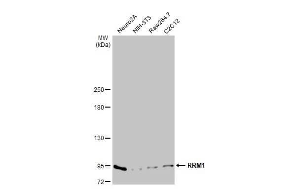 RRM1 Antibody (HL1231) - Azide and BSA Free