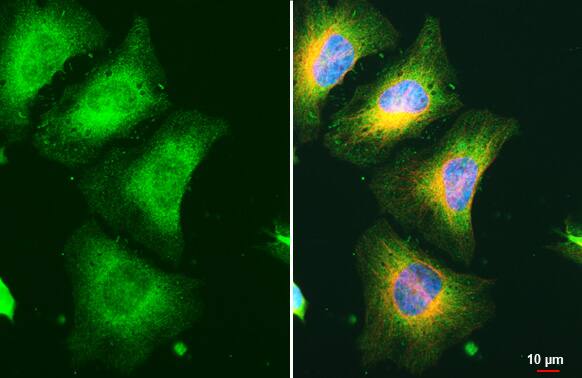 RRM1 Antibody (HL1231) - Azide and BSA Free