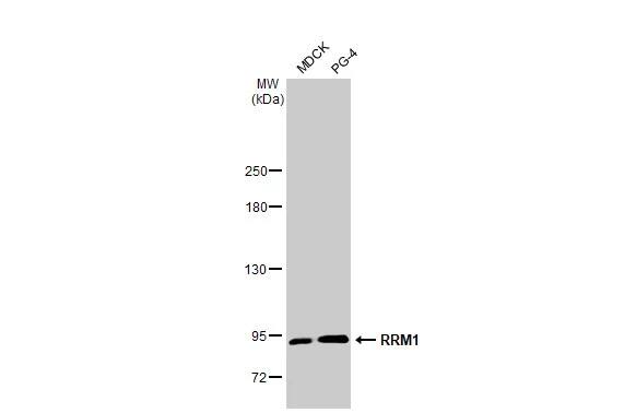 RRM1 Antibody (HL1231) - Azide and BSA Free
