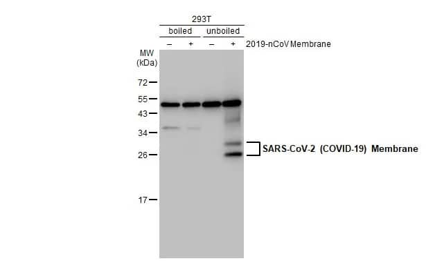SARS-CoV-2 Membrane Protein Antibody (HL1088) - Azide and BSA Free