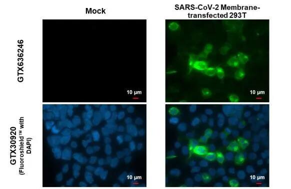 SARS-CoV-2 Membrane Protein Antibody (HL1088) - Azide and BSA Free