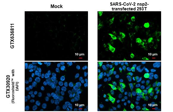 SARS-CoV-2 nsp2 Antibody (HL1371) - Azide and BSA Free