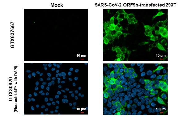 SARS-CoV-2 ORF9b Antibody (HL1918) - Azide and BSA Free