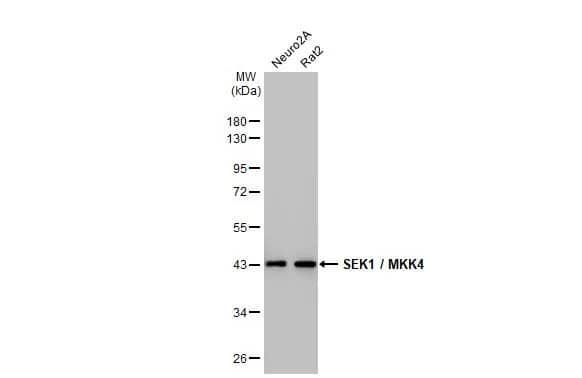 MKK4/MEK4 Antibody (HL1839) - Azide and BSA Free