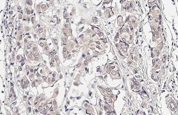 MKK4/MEK4 Antibody (HL1839) - Azide and BSA Free