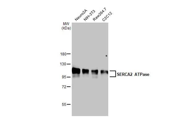 SERCA2 ATPase Antibody (HL2352) - Azide and BSA Free