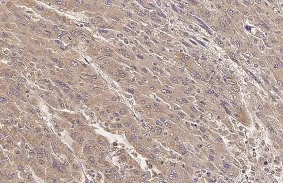 SERCA2 ATPase Antibody (HL2352) - Azide and BSA Free