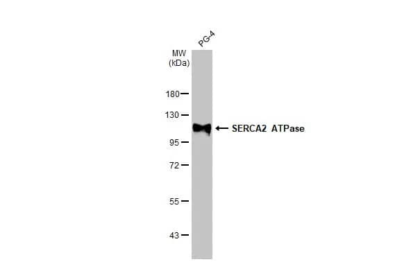 SERCA2 ATPase Antibody (HL2352) - Azide and BSA Free