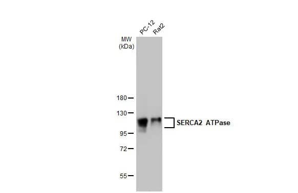SERCA2 ATPase Antibody (HL2352) - Azide and BSA Free