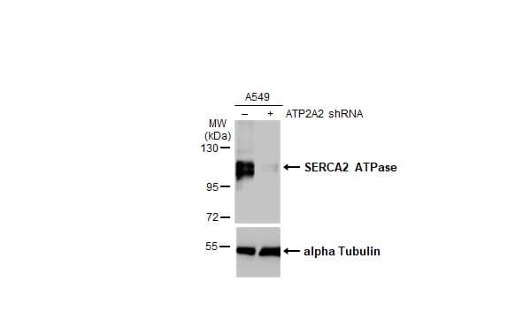 SERCA2 ATPase Antibody (HL2352) - Azide and BSA Free
