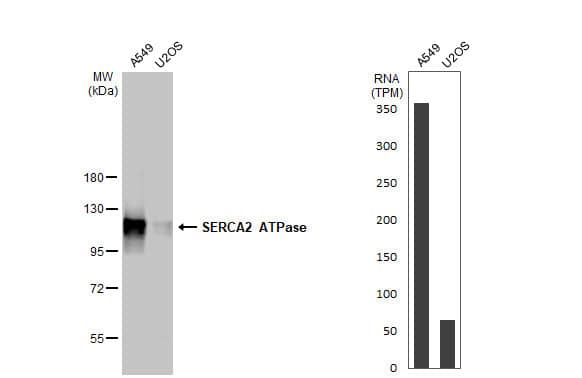 SERCA2 ATPase Antibody (HL2352) - Azide and BSA Free