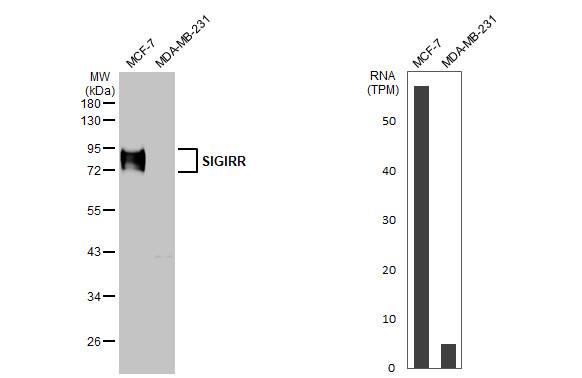 SIGIRR Antibody (HL2008) - Azide and BSA Free