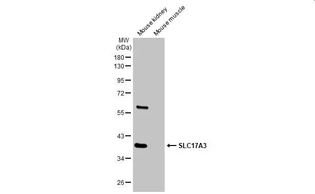 SLC17A3 Antibody - Azide and BSA Free