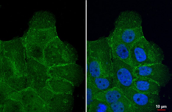 SLC1A5 Antibody (HL1617) - Azide and BSA Free