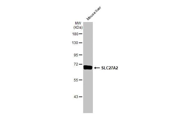 FATP2/SLC27A2 Antibody (HL2232) - Azide and BSA Free