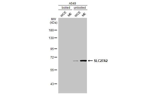 FATP2/SLC27A2 Antibody (HL2232) - Azide and BSA Free