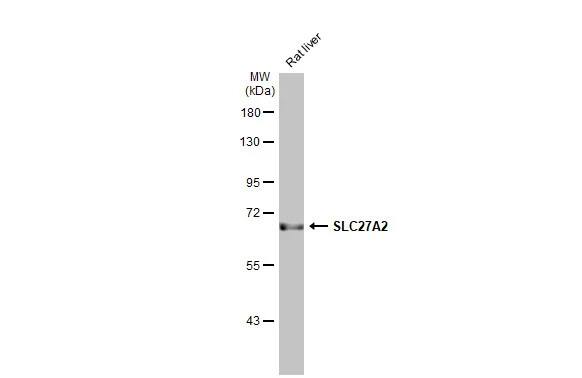 FATP2/SLC27A2 Antibody (HL2232) - Azide and BSA Free