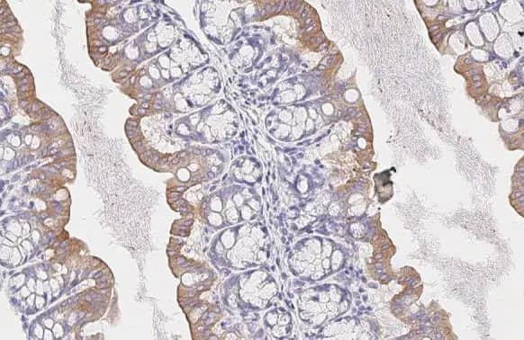 SMYD3 Antibody (HL2464) - Azide and BSA Free