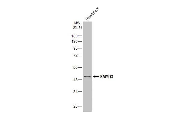 SMYD3 Antibody (HL2464) - Azide and BSA Free