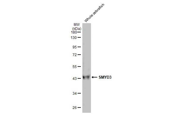 SMYD3 Antibody (HL2464) - Azide and BSA Free