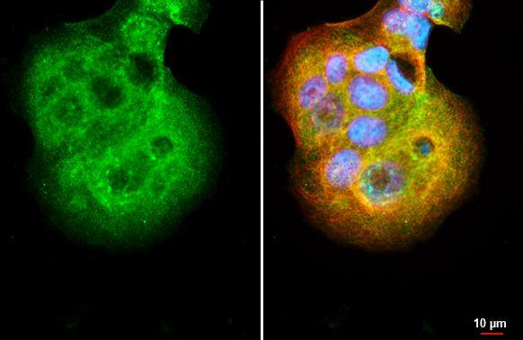 SMYD3 Antibody (HL2464) - Azide and BSA Free