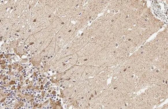 AP180 Antibody (HL1657) - Azide and BSA Free