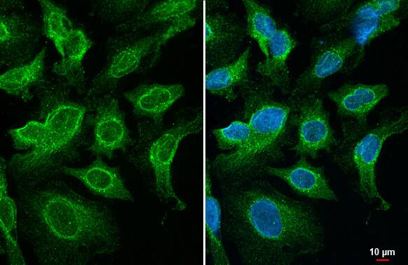 SNX5 Antibody (HL2375) - Azide and BSA Free