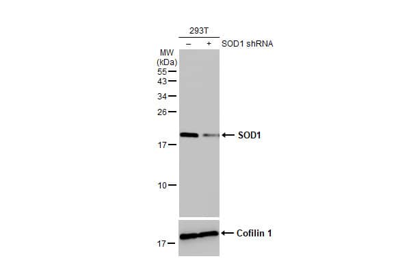 SOD1/Cu-Zn SOD Antibody (HL1652) - Azide and BSA Free
