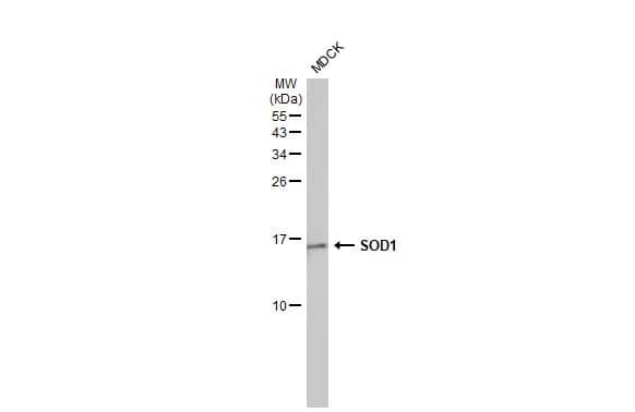 SOD1/Cu-Zn SOD Antibody (HL1652) - Azide and BSA Free
