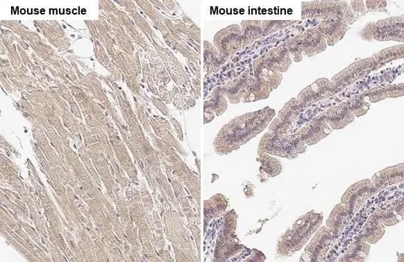 SPG7 Antibody (HL2236) - Azide and BSA Free (NBP3-25694) by SPG7 Antibody (HL2236) - Azide and BSA Free (NBP3-25694) by