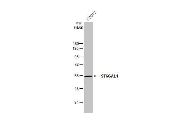 ST6 Gal Sialyltransferase 1/ST6GAL1/CD75 Antibody (HL2318) - Azide and BSA Free