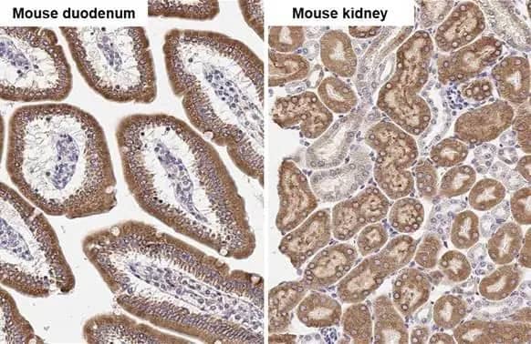 ST6 Gal Sialyltransferase 1/ST6GAL1/CD75 Antibody (HL2318) - Azide and BSA Free