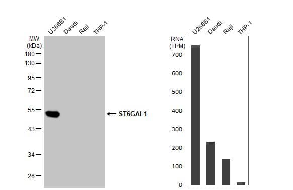 ST6 Gal Sialyltransferase 1/ST6GAL1/CD75 Antibody (HL2318) - Azide and BSA Free