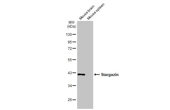 Stargazin Antibody (HL2268) - Azide and BSA Free