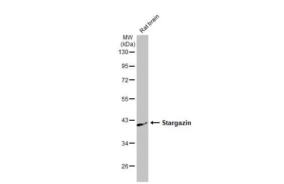 Stargazin Antibody (HL2268) - Azide and BSA Free