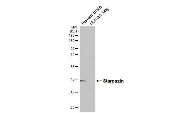 Stargazin Antibody (HL2268) - Azide and BSA Free
