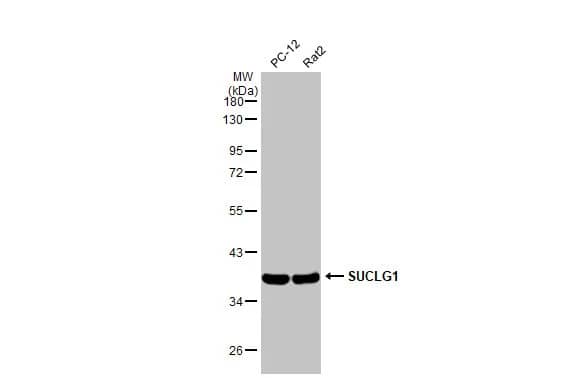 SUCLG1 Antibody (HL2387) - Azide and BSA Free