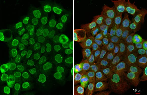 SUN1 Antibody (HL1946) - Azide and BSA Free