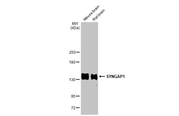 SynGAP Antibody (HL2292) - Azide and BSA Free