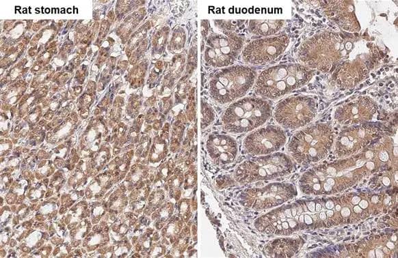 TBC1D5 Antibody (HL2054) - Azide and BSA Free