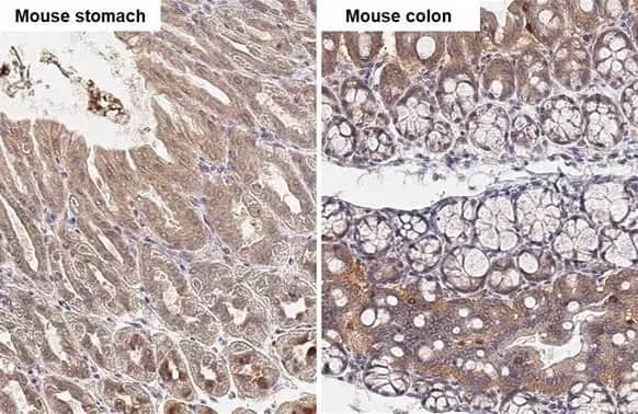 TBC1D5 Antibody (HL2390) - Azide and BSA Free