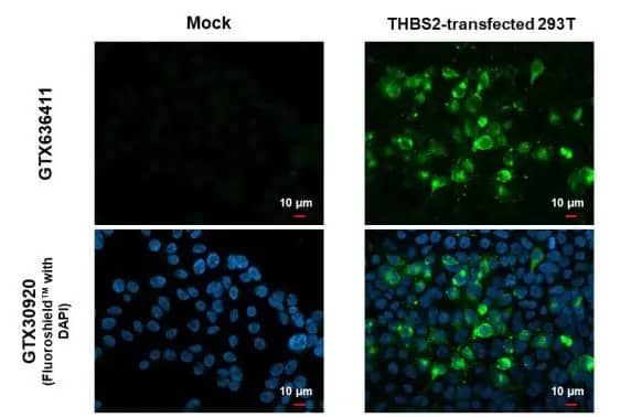 Thrombospondin-2 Antibody (HL1140) - Azide and BSA Free